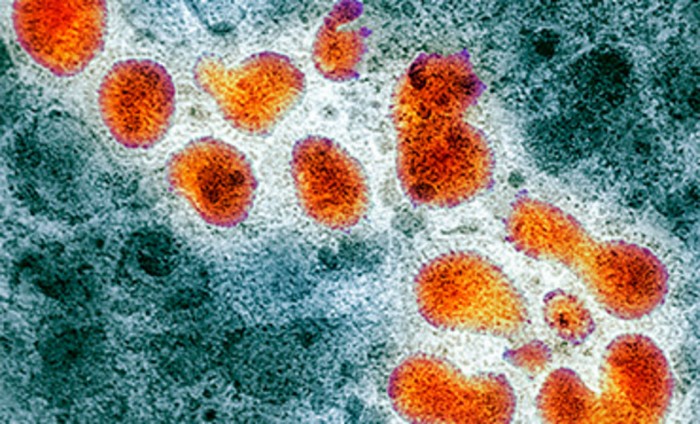 Influenza- avian_H.jpg